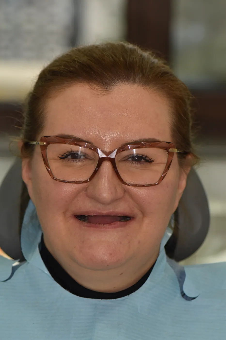 Pacienta înainte de tratament