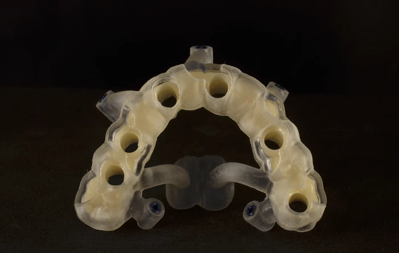 Ghid chirurgical imprimat 3D pentru inserarea implanturilor la o arcadă completă, cu manșoanele prin care trec frezele