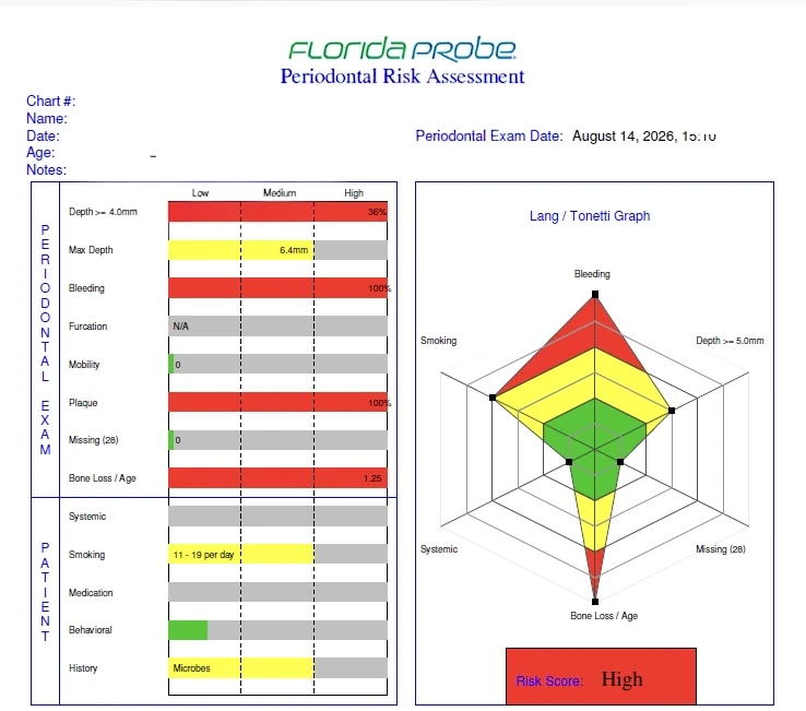 Evaluarea riscului parodontal Florida Probe, exemplu anonimizat